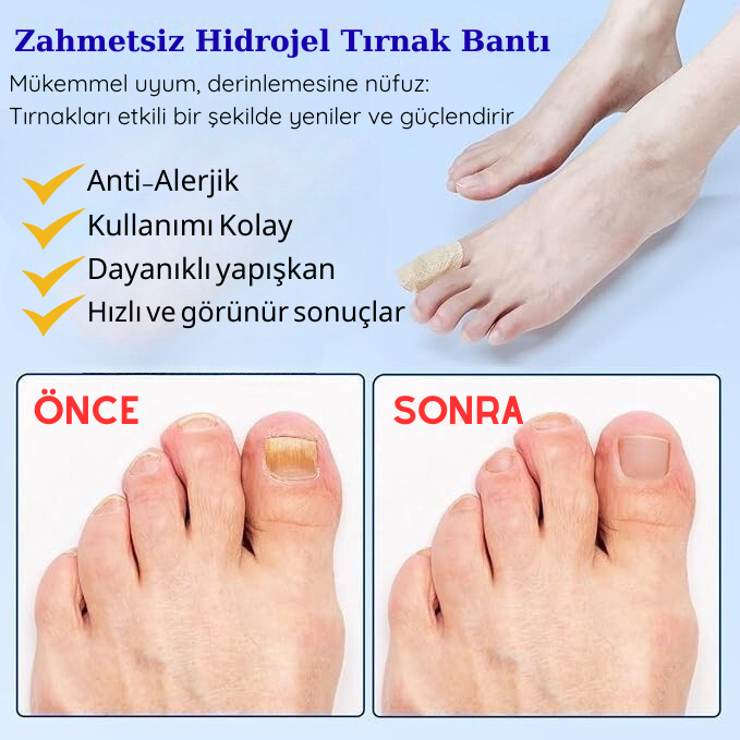 Pedicurexs Mantar İyileştirme Bantı